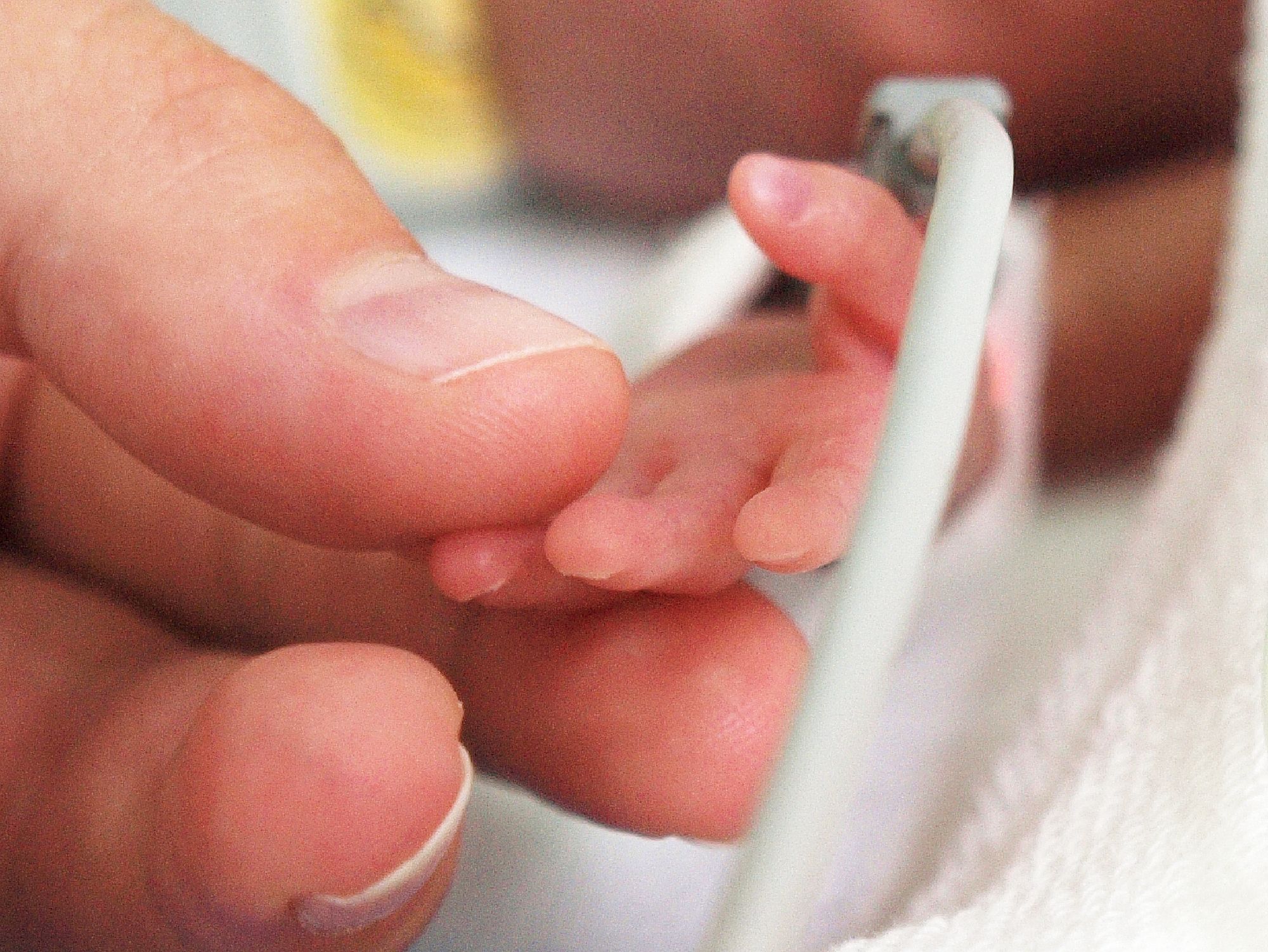 Mother is holding a tiny hand of her preterm baby that is in the NICU.