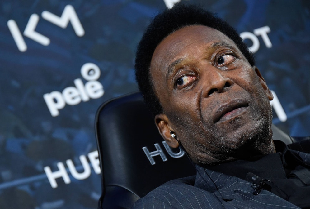 Pele befindet sich weiter auf der Intensivstation. 