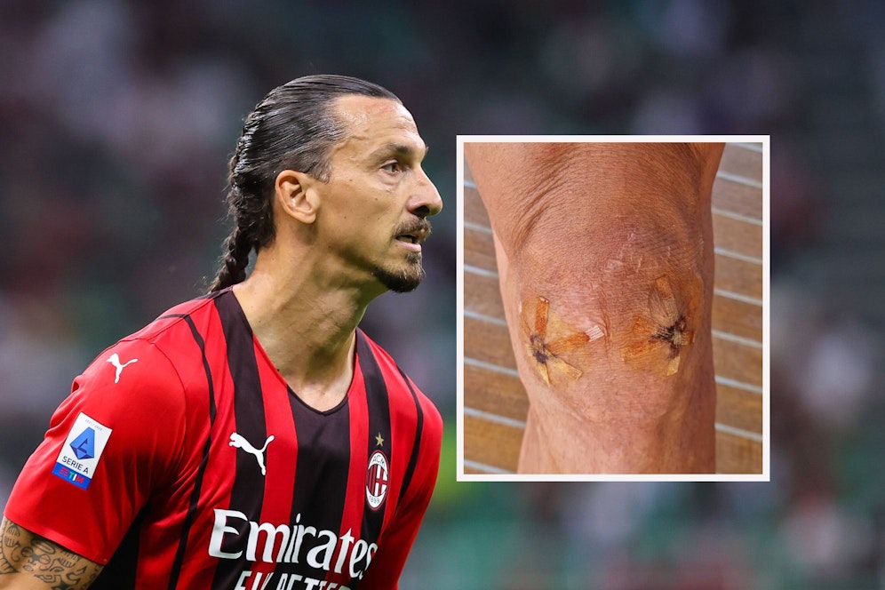 Zlatan Ibrahimovic mit neuer Frisur (l.) und altem Knie (r.)