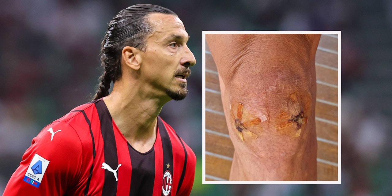 fussball-ibrahimovic-trifft-bei-comeback-und-zeigt-knie-und-zopf