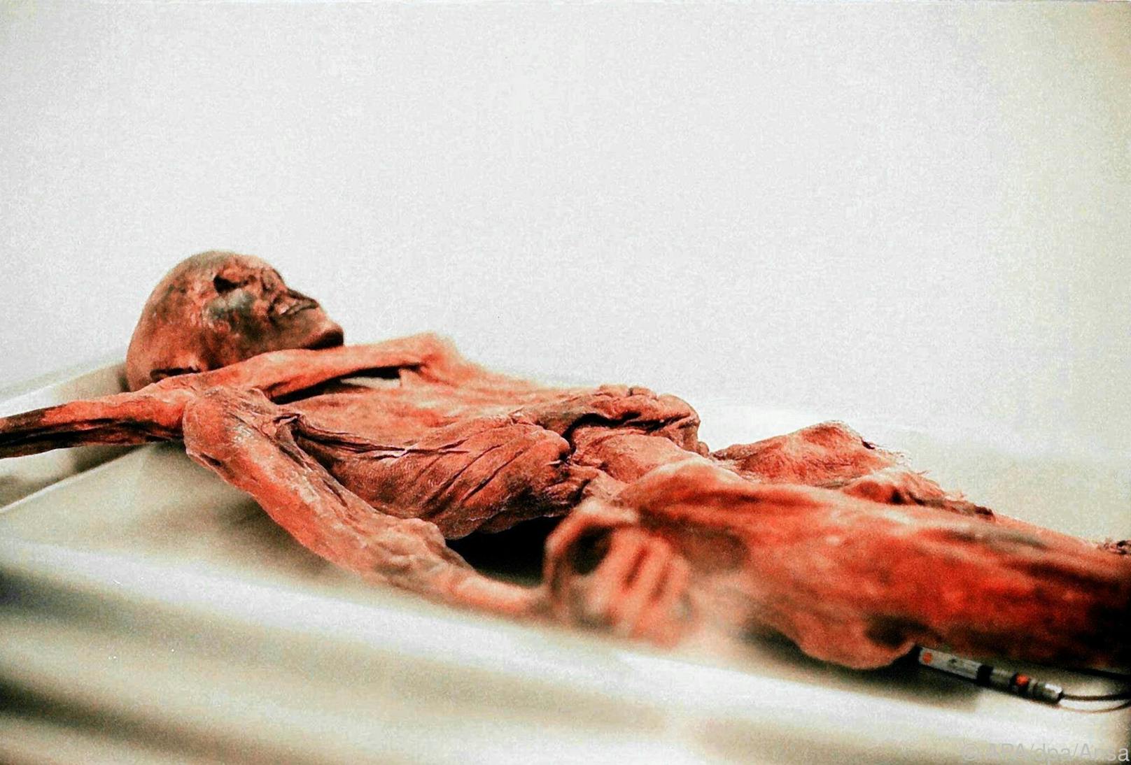 Ötzi dürfte an den Verletzungsfolgen eines Kampfes gestorben sein.