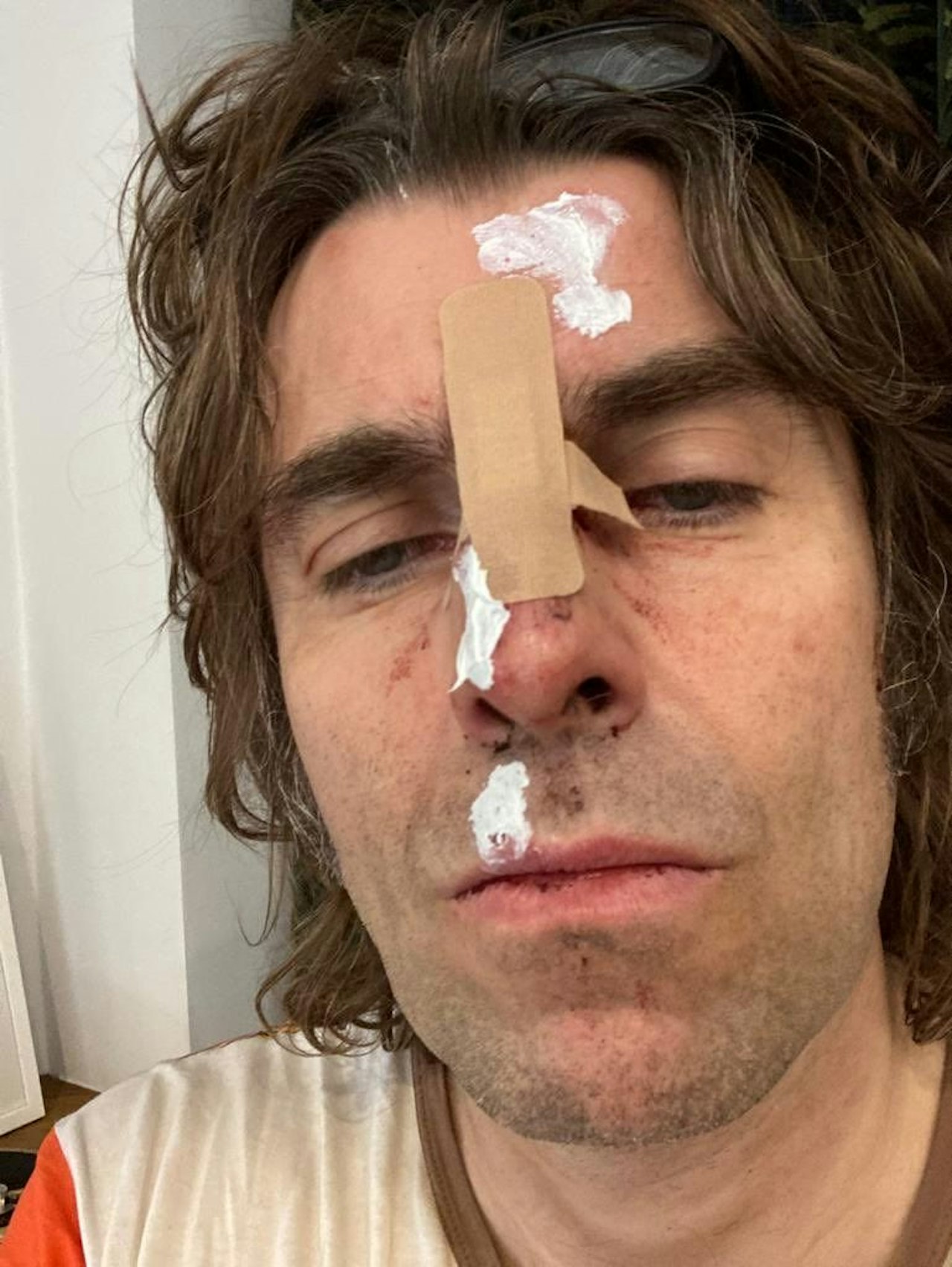 Heute.at - Oasis-Sänger Liam Gallagher bei Heli-Absturz verletzt