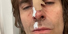Oasis-Sänger Liam Gallagher bei Heli-Absturz verletzt
