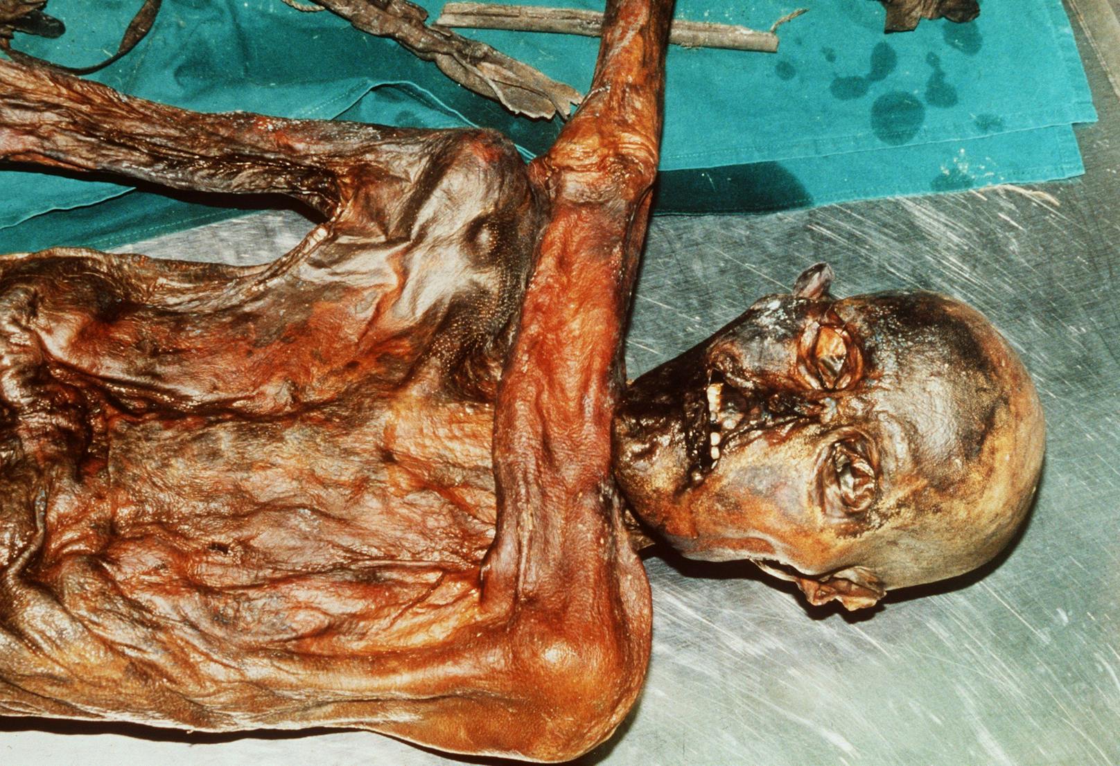 So sah Ötzi aus, als er 1991 gefunden wurde.