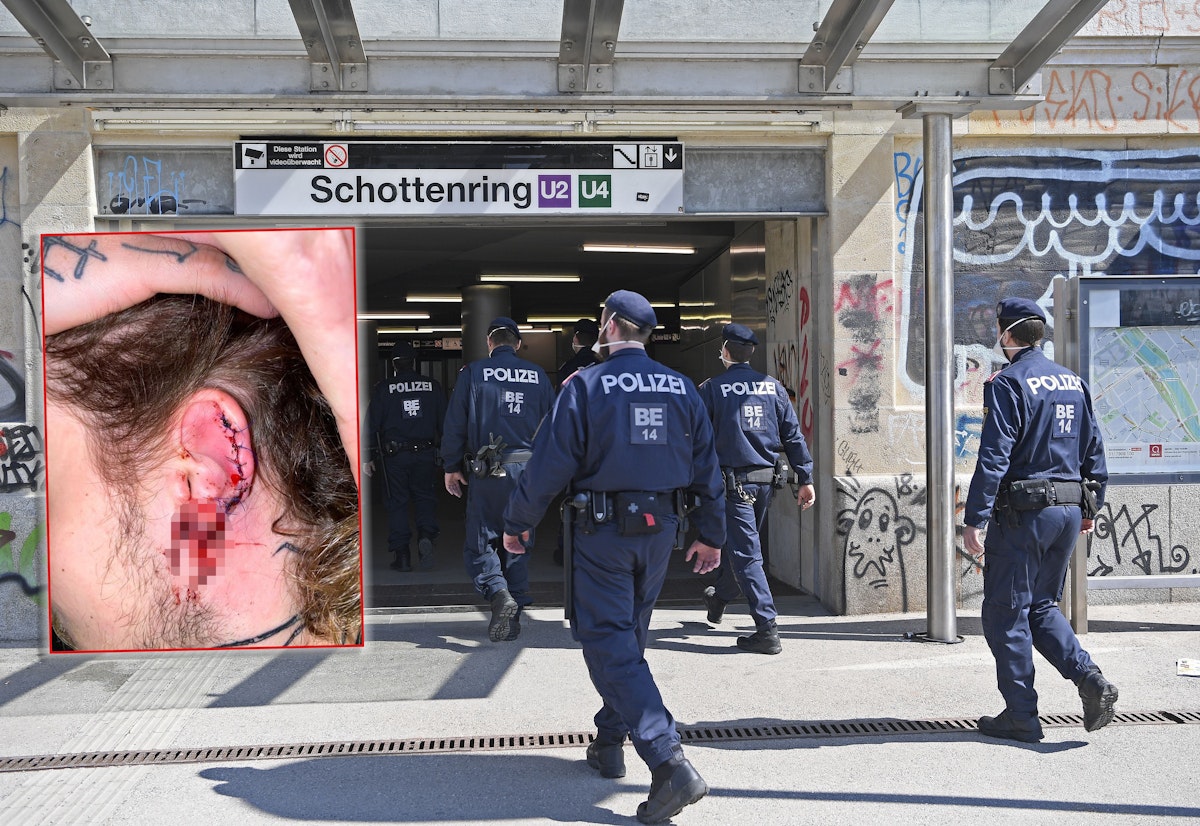 Dem 21-Jährigen wurde das Ohr abgebissen.