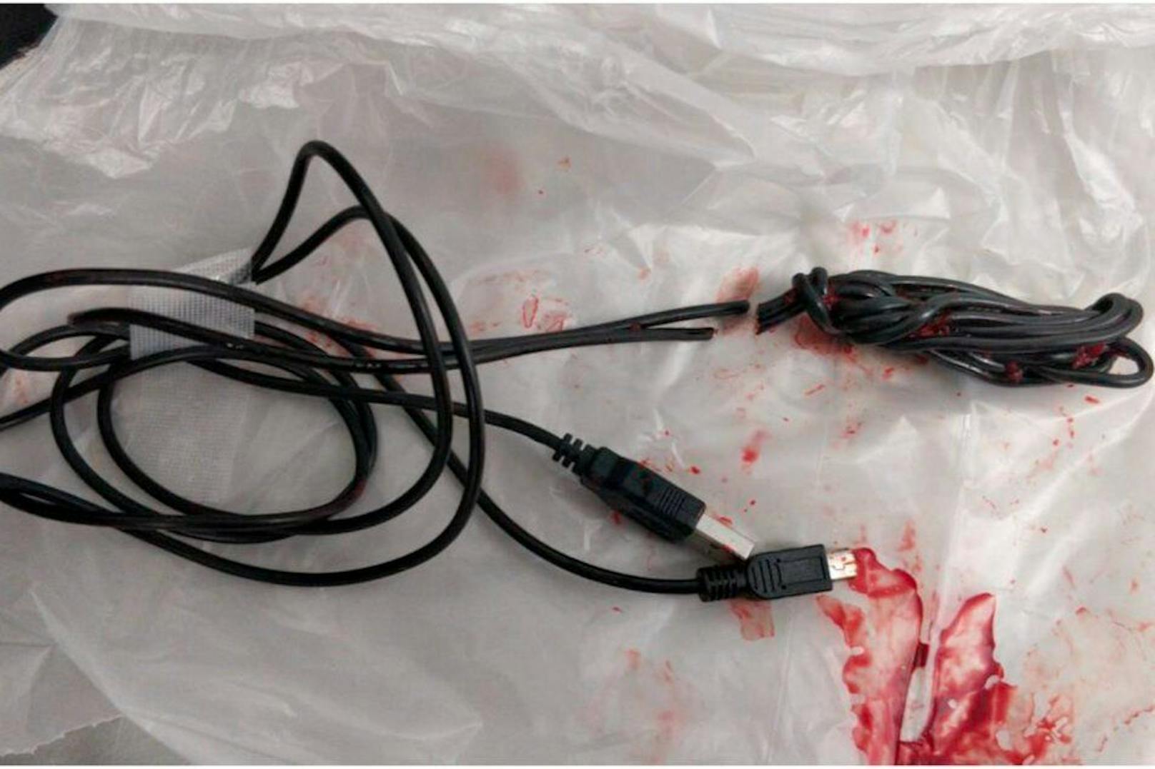 Durch eine Not-OP konnte das Kabel wieder aus dem Körper des Jungen entfernt werden.