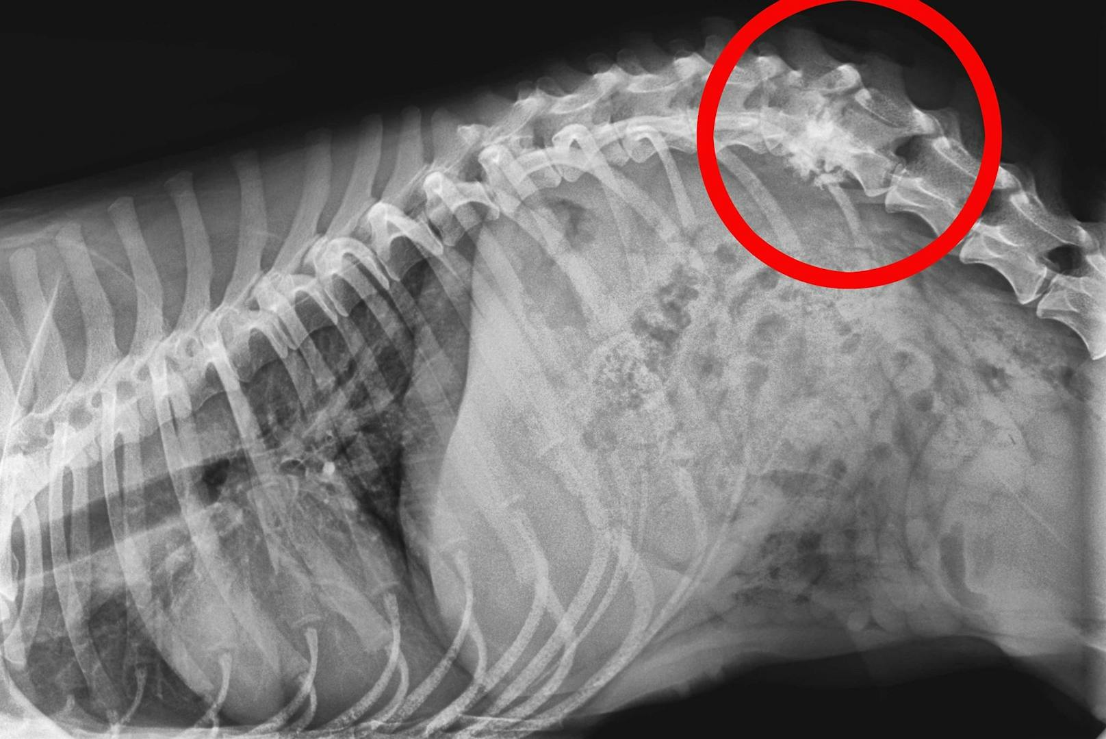 Die Röntgenaufnahme zeigt die Verletzung an der Wirbelsäule.