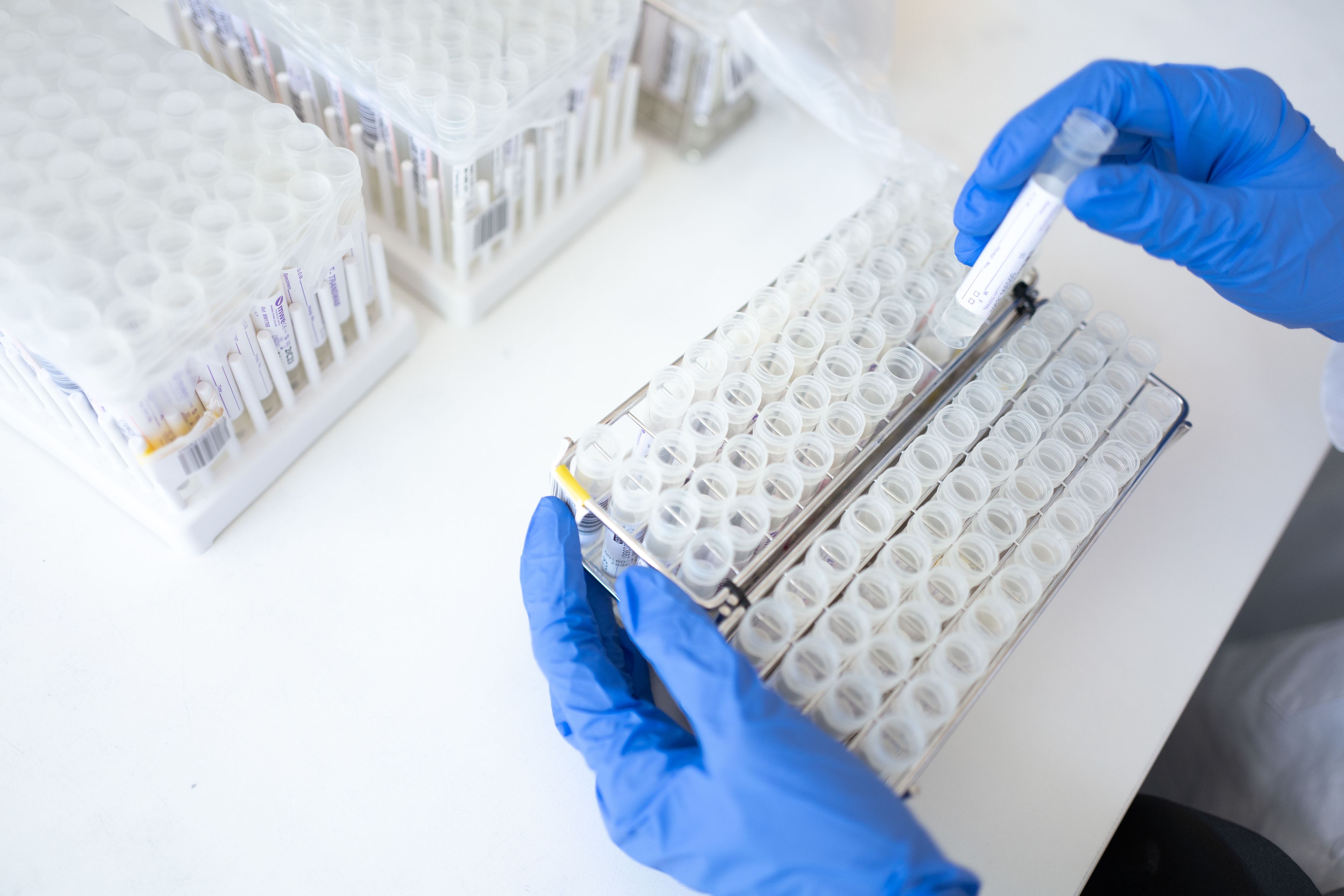 Ab 27. September wird die behördliche Absonderung von 14 auf zehn Tage verkürzt