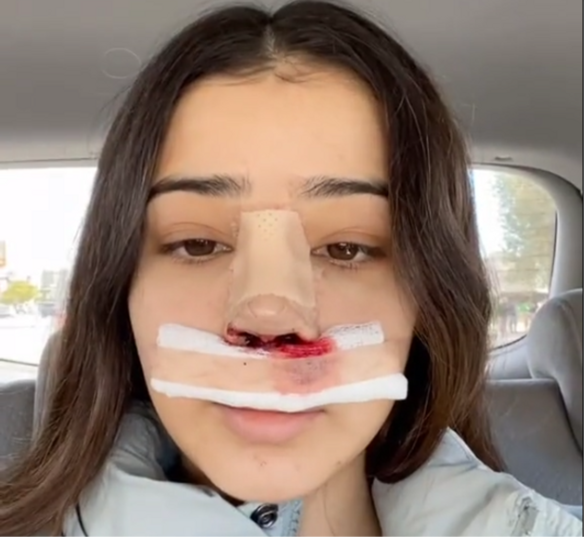 Beauty-OPs werden in sozialen Netzwerken beworben.