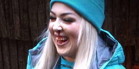 <strong>Lydia</strong> ist Krawall gewohnt. Auch mit blutiger Nase dreht sie in der "Dschungelshow" ordentlich auf die Tube.<br>