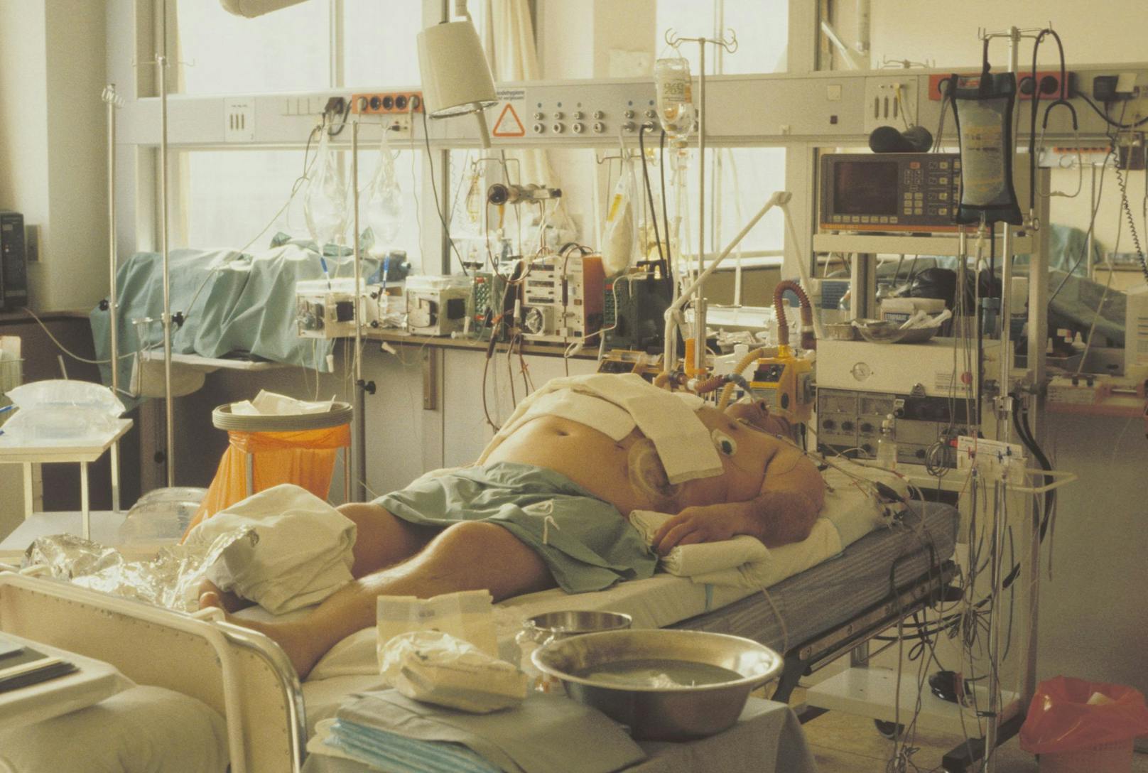 Ein Patient wird auf der Intensivstation eines Spitals in Österreich behandelt.