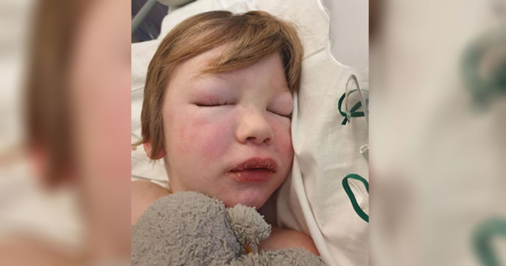 Logan Walsh ist über den Berg. Seine schlimme - vermutlich - Folgeerkrankung ist allerdings kein Einzelfall.