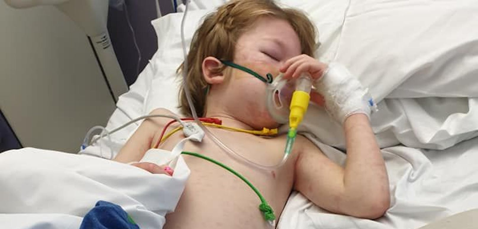 Der sechsjährige Logan Walsh aus Großbritannien hatte eine Corona-Infektion ohne Symptome. Sechs Wochen später landete er auf der Intensivstation.