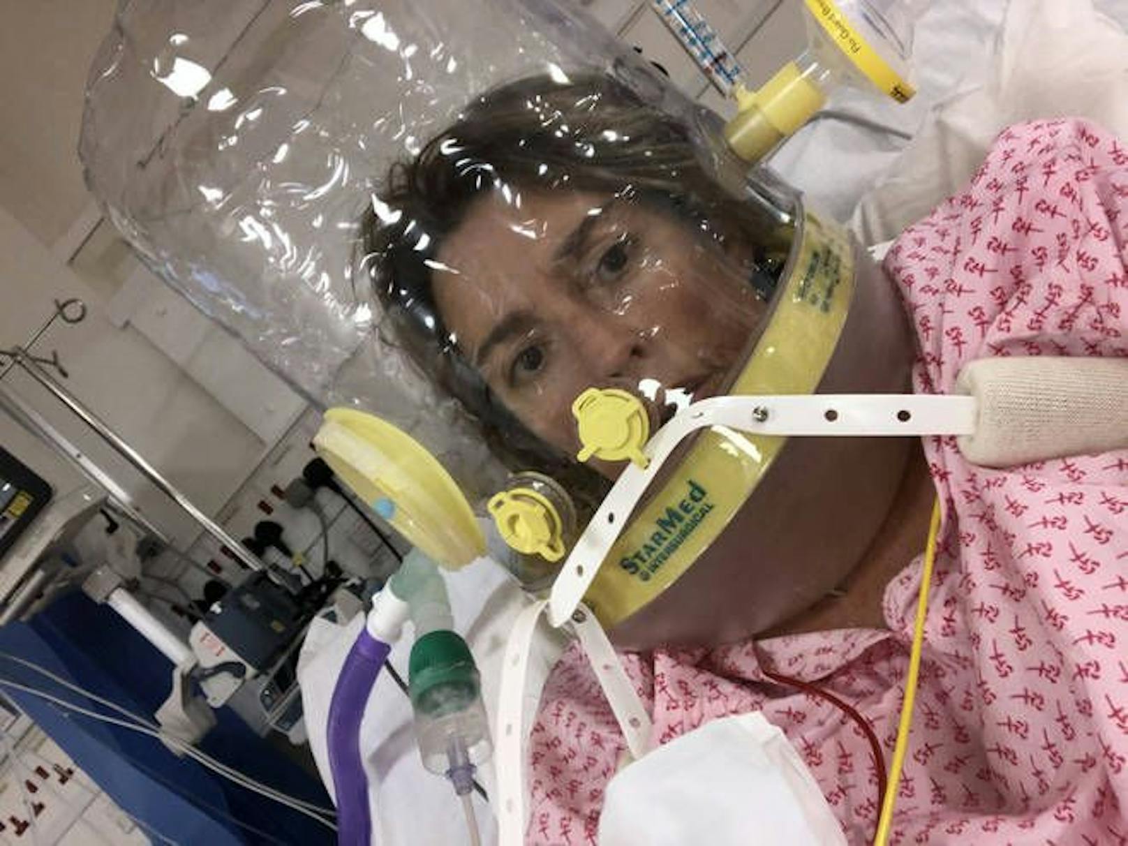 Sharma selbst&nbsp;musste einen Monat lang für 24 Stunden am Tag eine Plastikhaube tragen, über die Sauerstoff in ihre Lungen gepresst wurde.