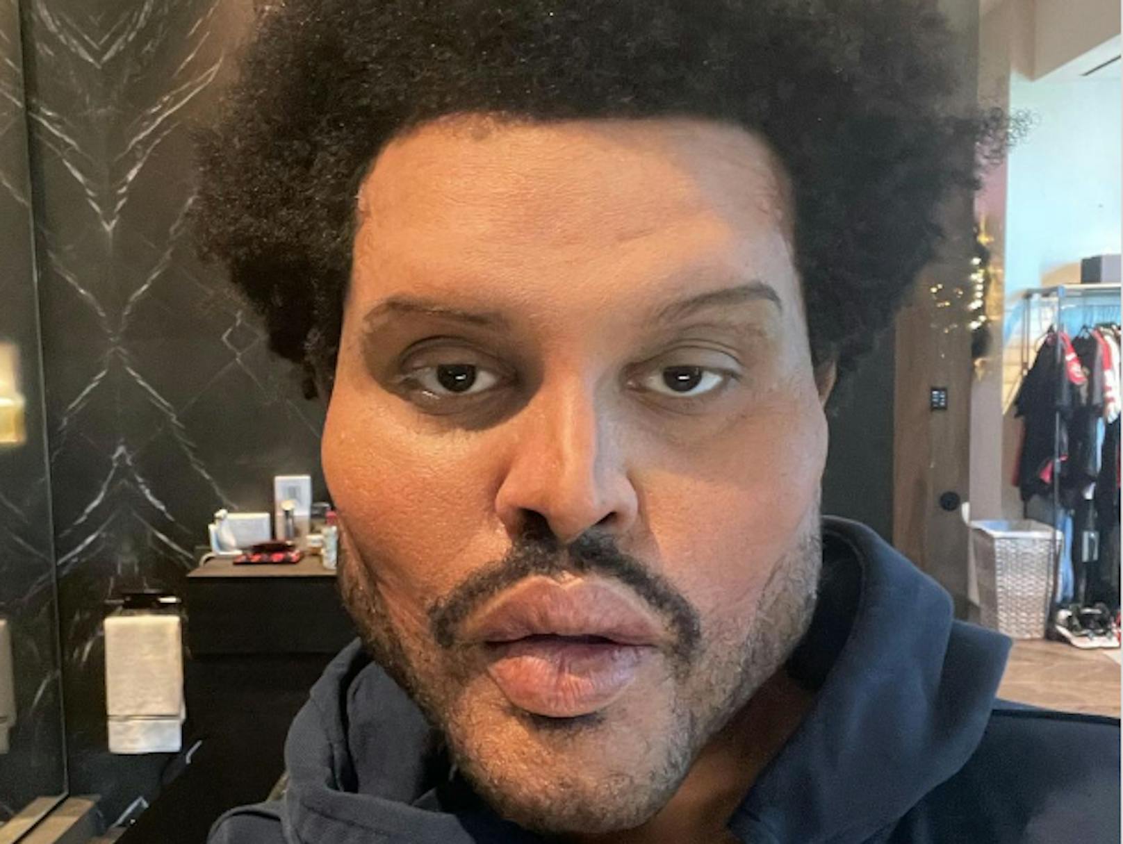 Sänger The Weeknd sorgt mit diesem Selfie für Entsetzen. Hat sich der Sänger für sein neues Musikvideo sein Gesicht tatsächlich mit Schönheits-OPs entstellt?<br>