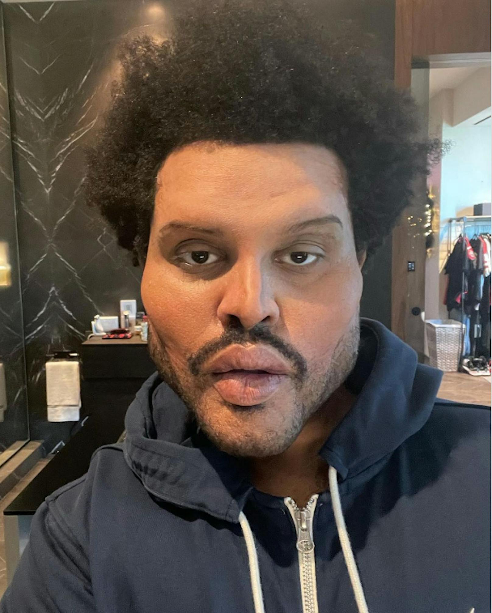 The Weeknd schockt Fans mit neuem Gesicht