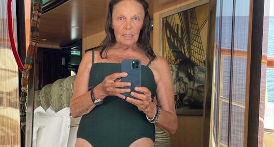 Diane von Furstenberg hält nichts von Schönheits-OPs und sagt das auch offen auf Instagram.