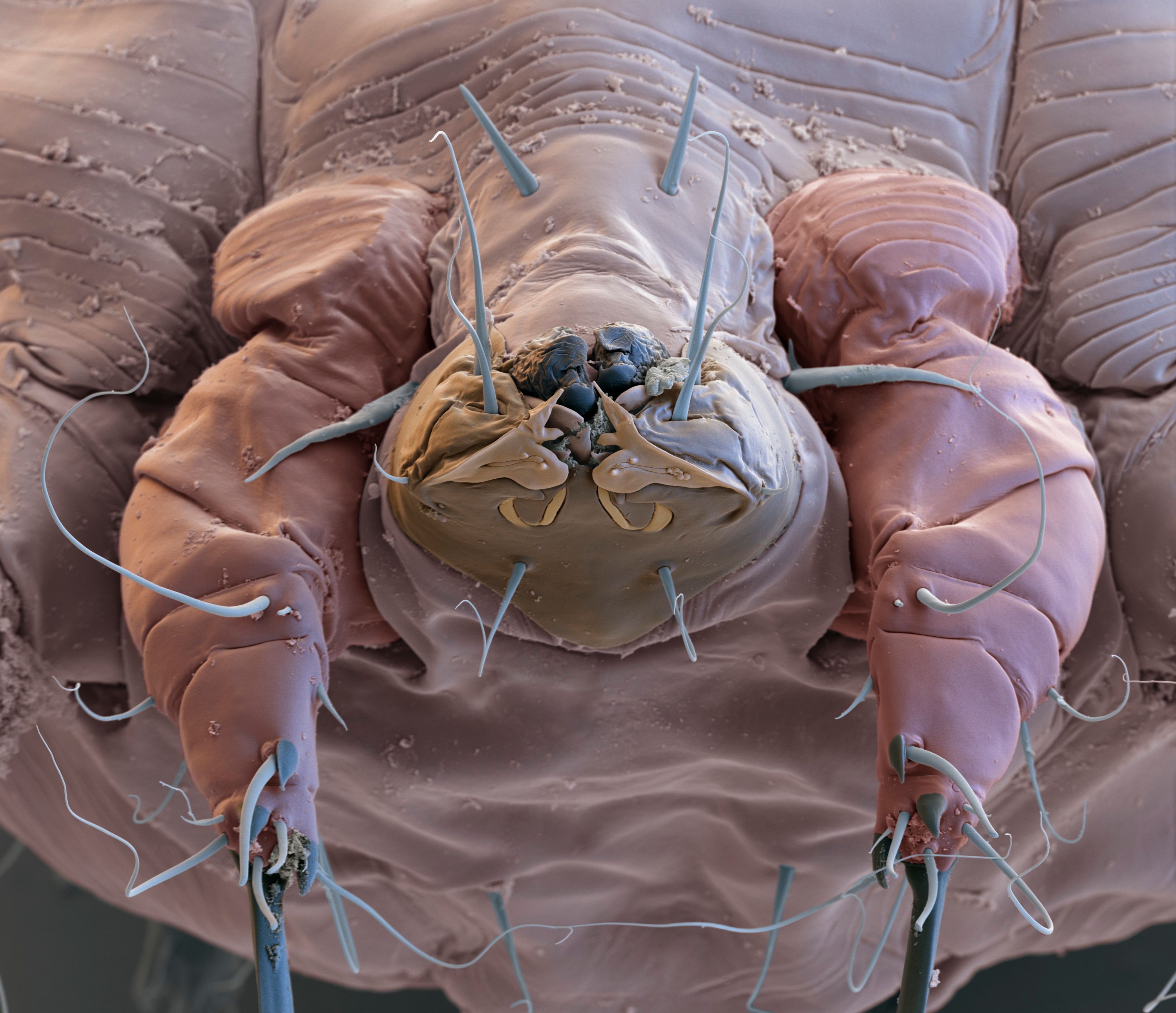 So sieht die Krätzmilbe in extremer Vergrößerung aus.