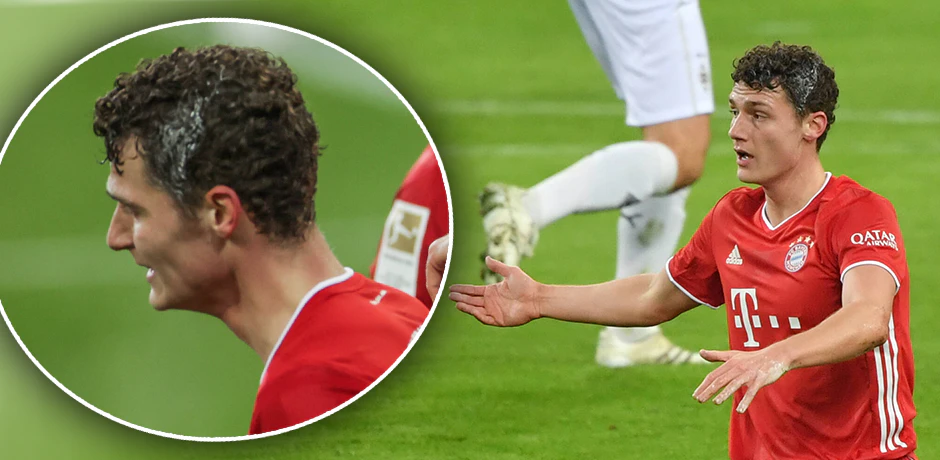 Benjamin Pavard nach der Vogel-Attacke