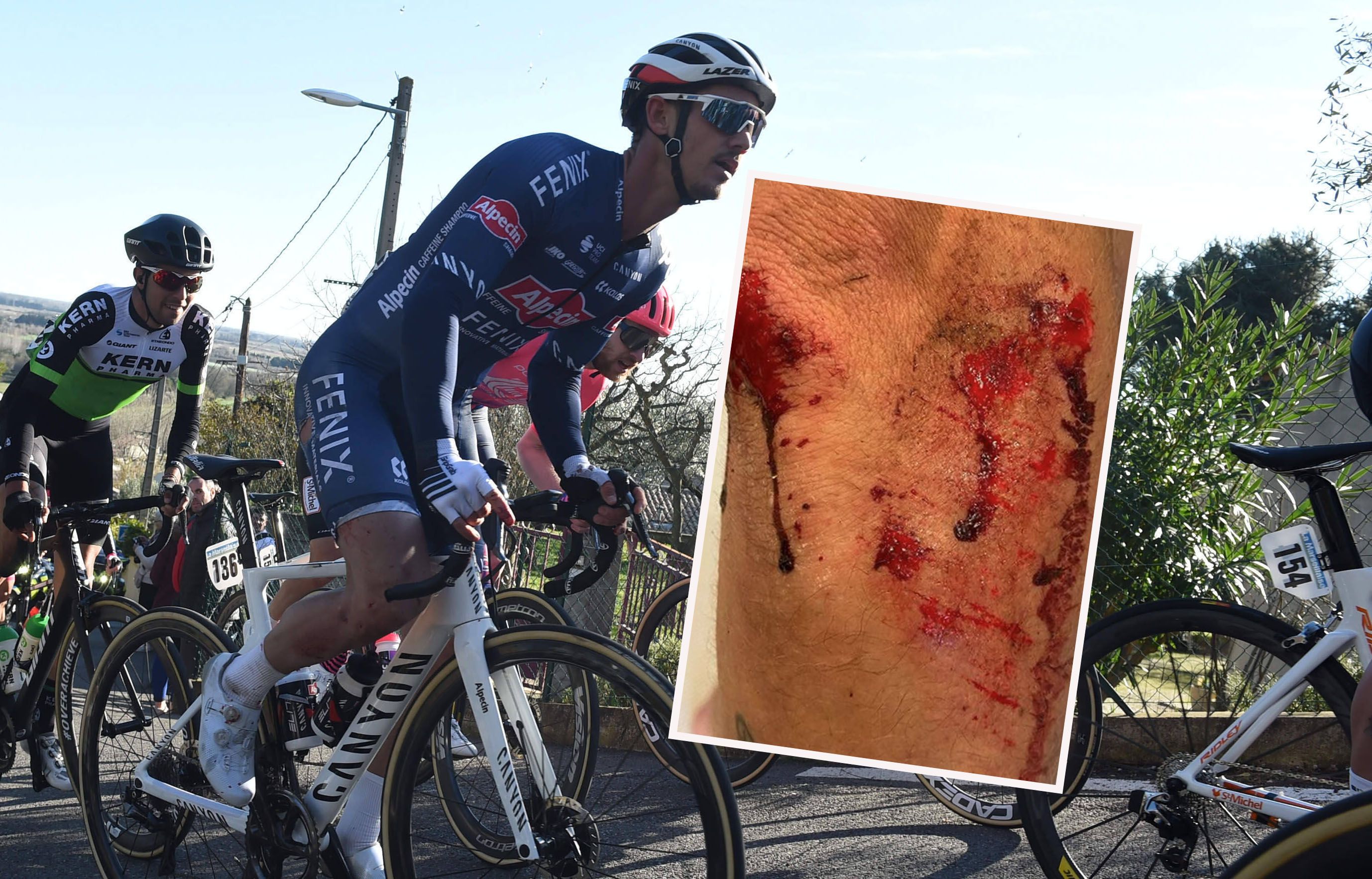 Alexandar Richardson zeigt sein Knie nach dem Überfall.