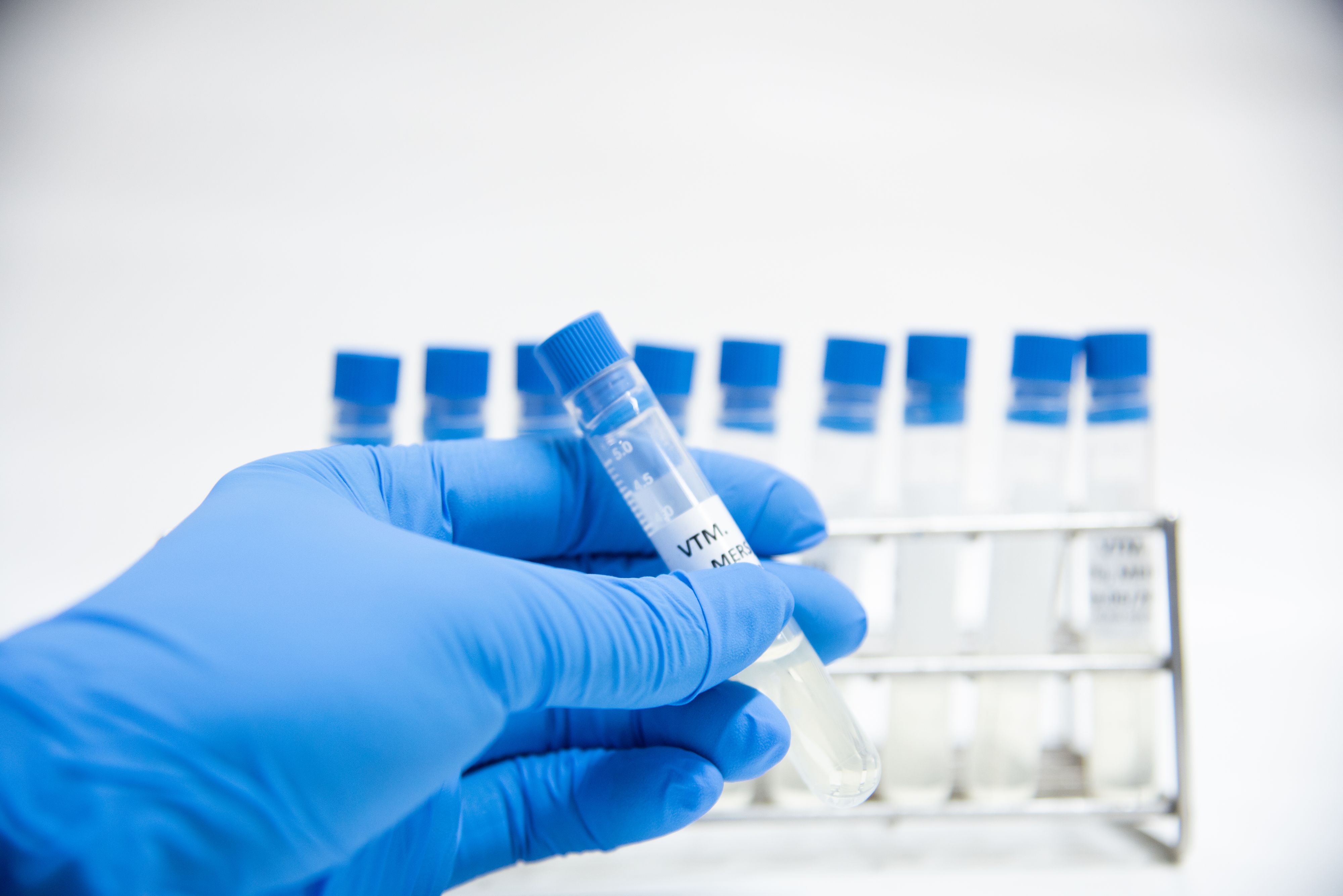 Viral transportation media (VTM)specimen collection Covid-19 with scientist and blue glove.
