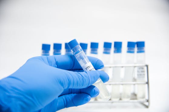 Das lösliche APN01 soll das SARS-CoV-2-Virus bereits am Einfallstor blockieren und den entzündlichen Reaktionen in der Lunge entgegengewirkt.