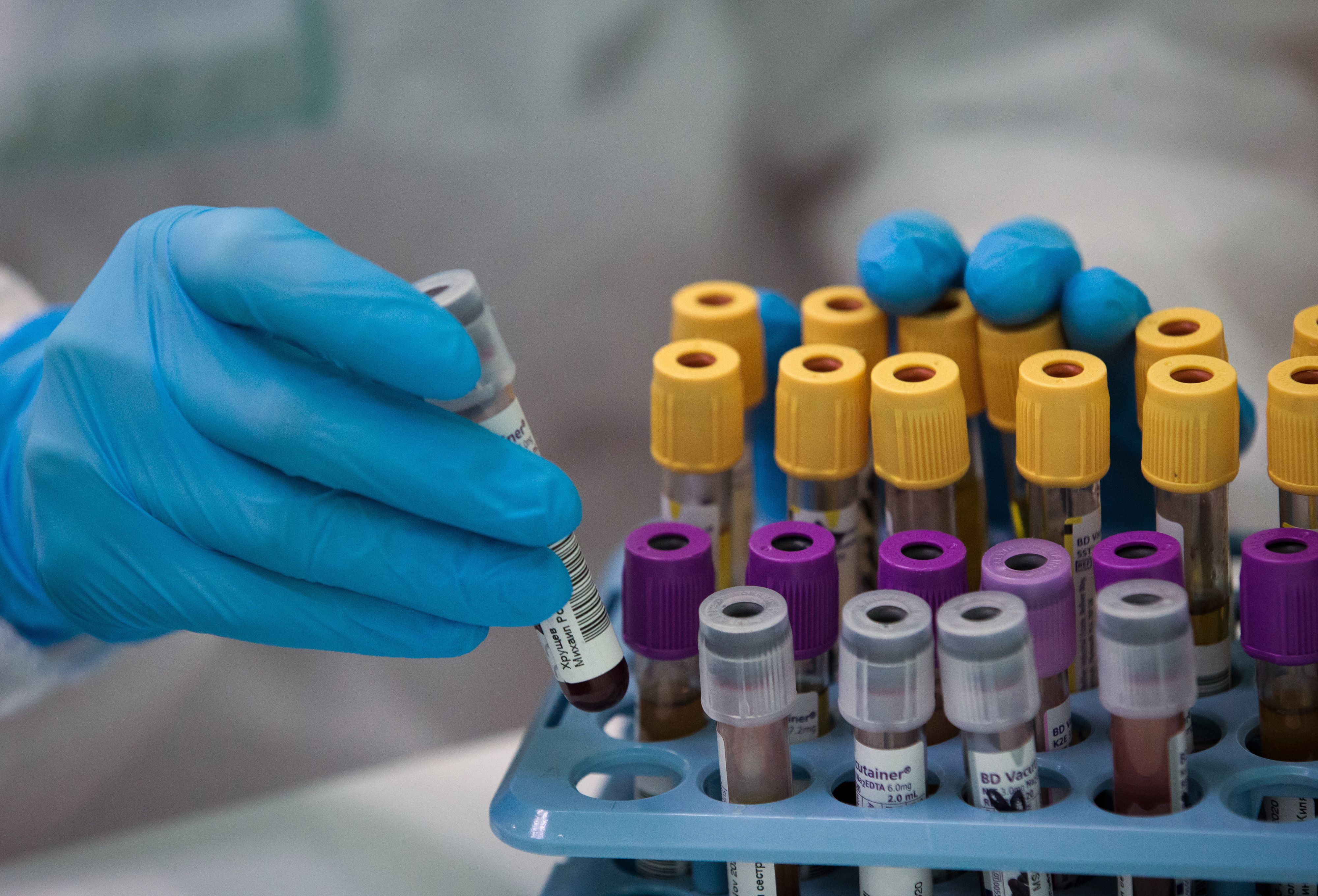 Download von www.picturedesk.com am 14.10.2021 (12:07).  SIMFEROPOL, CRIMEA, RUSSIA - NOVEMBER 20, 2020: A medical worker handles blood samples for COVID-19 antibody testing at a Gemotest lab. Sergei Malgavko/TASS - 20201120_PD3640 - Rechteinfo: Rights Managed (RM)