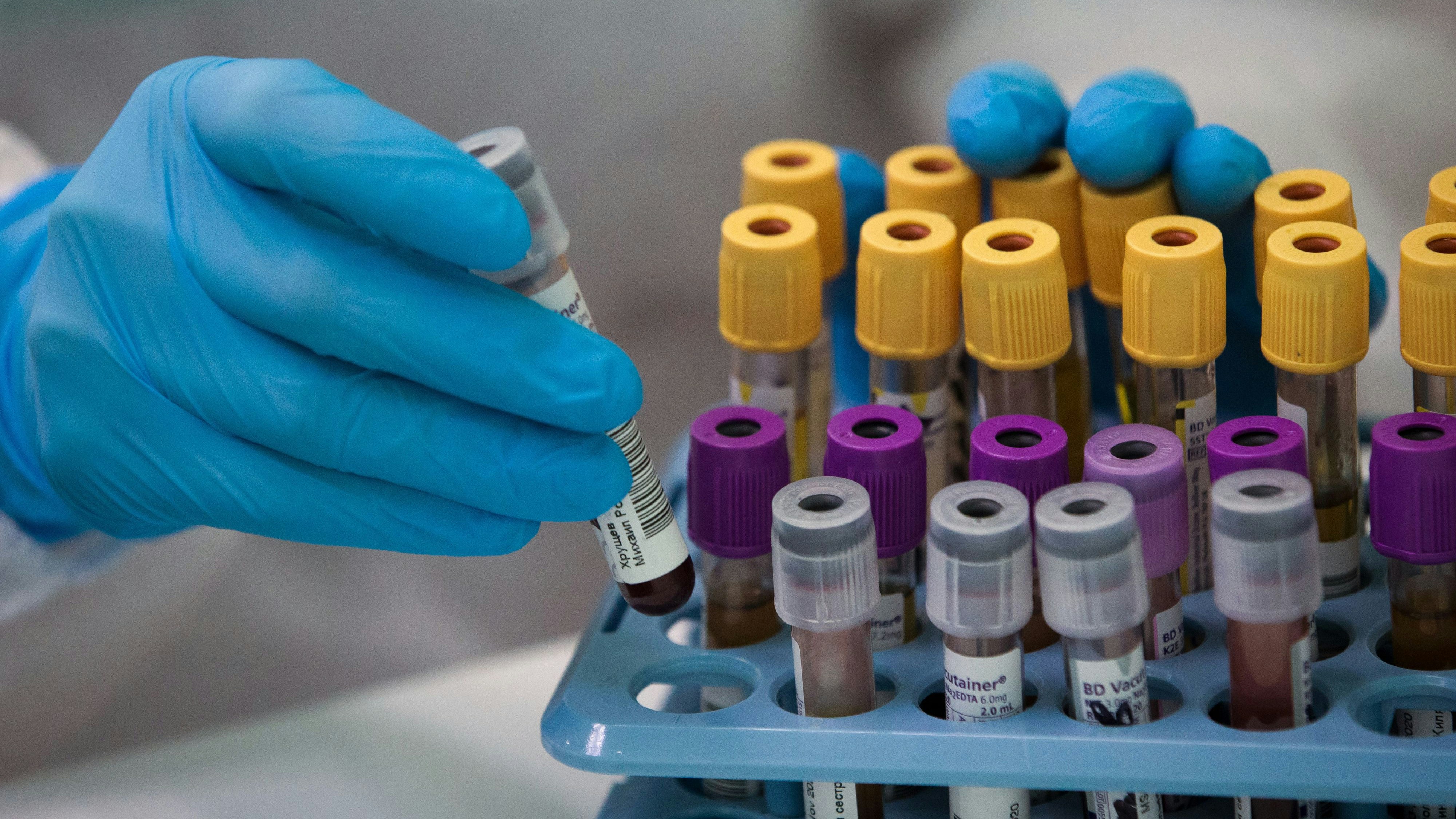 Download von www.picturedesk.com am 14.10.2021 (12:07).  SIMFEROPOL, CRIMEA, RUSSIA - NOVEMBER 20, 2020: A medical worker handles blood samples for COVID-19 antibody testing at a Gemotest lab. Sergei Malgavko/TASS - 20201120_PD3640 - Rechteinfo: Rights Managed (RM)