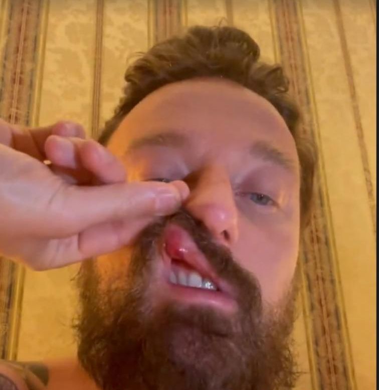 Francesco Facchinetti wurde zum Prügel-Opfer