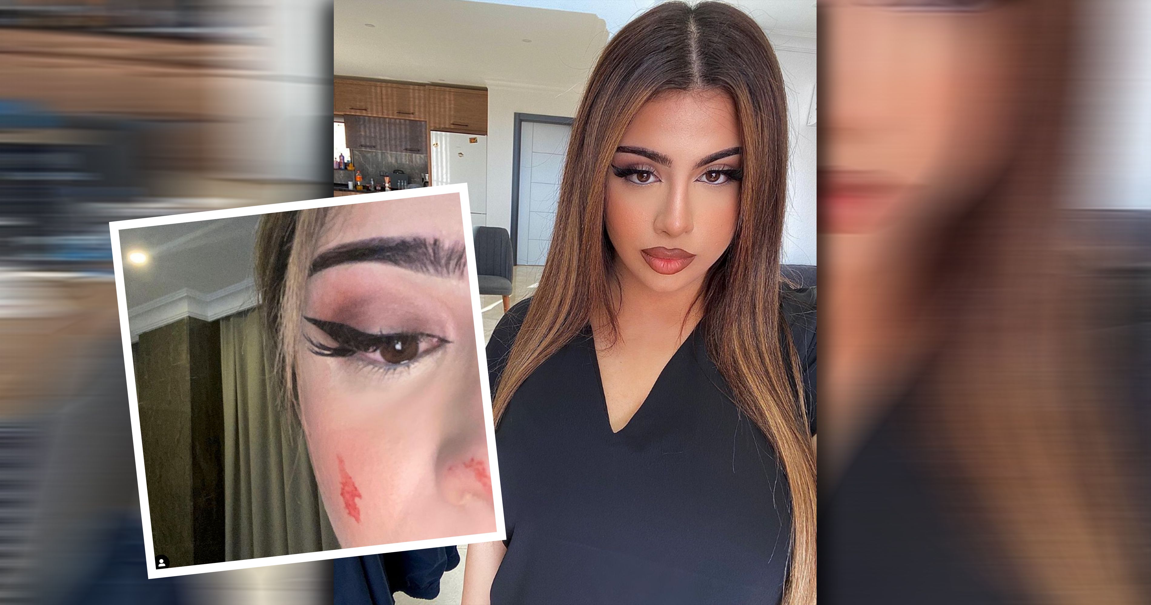 Lune zeigt die erschreckenden Fotos.