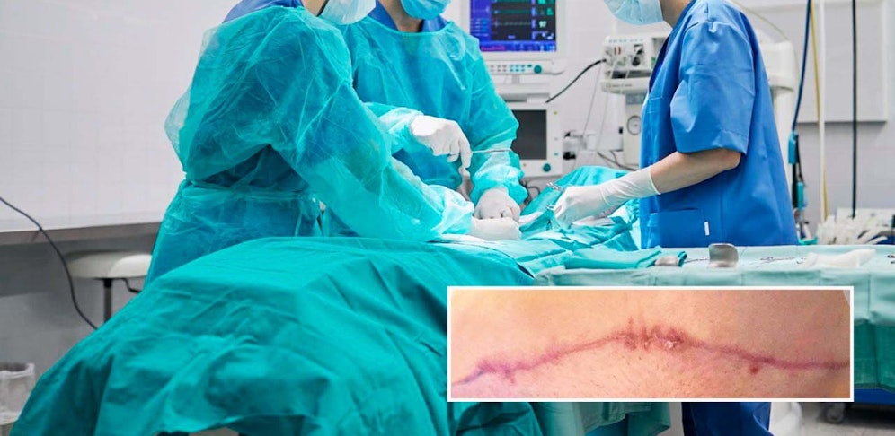 Anna G. leidet nach ihrer Brust- und Bauch-OP an starken Schmerzen. 