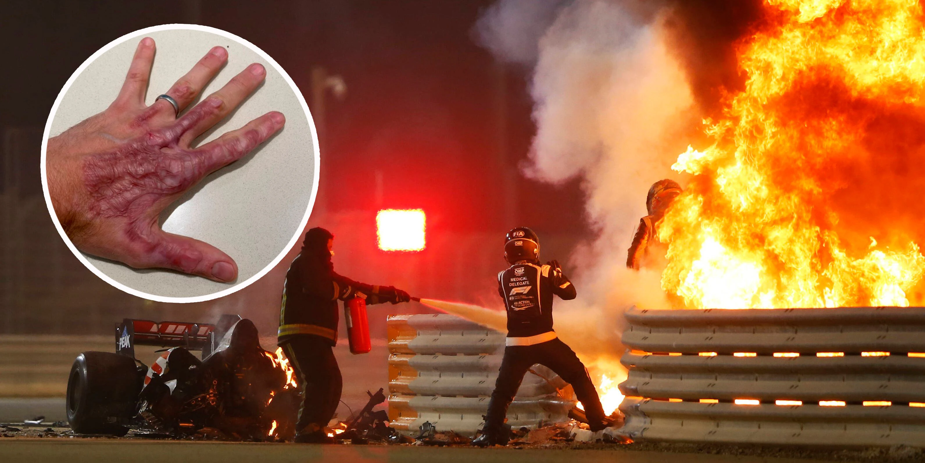 Romain Grosjean leidet immer noch an den Spätfolgen seines Feuer-Crashs.