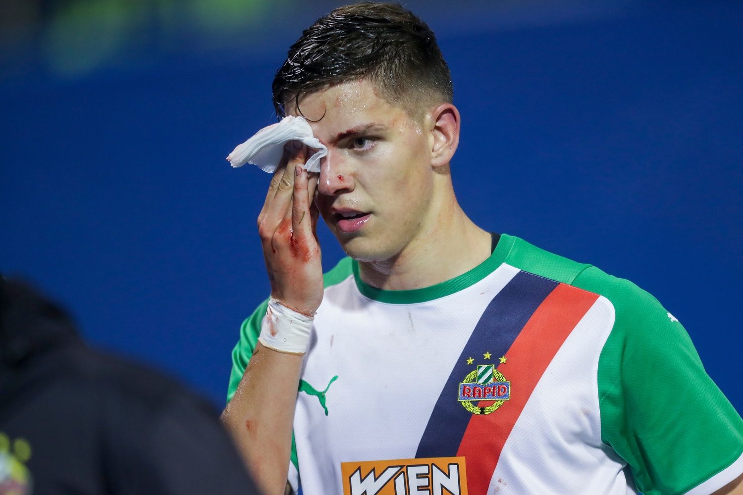 Martin Moormann musste nach 20 Minuten mit einer Blut-Wunde vom Platz. 