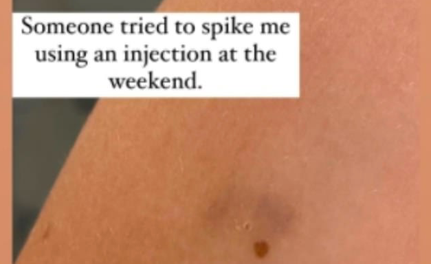 Die Insta-Story von "X-Factor UK"-Kandidatin Betsy-Blue English