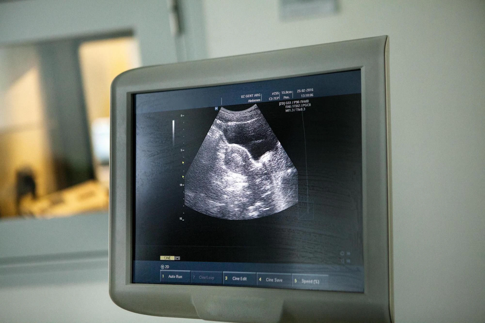 Falsches Kind geboren: Ihr Embryo war nach einer Verwechslung einem anderen Paar eingepflanzt worden, deren Baby eine Woche später geboren wurde. (Symbolbild)