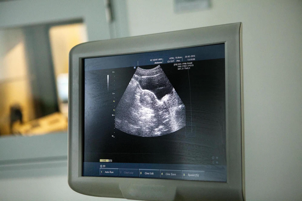Falsches Kind geboren: Ihr Embryo war nach einer Verwechslung einem anderen Paar eingepflanzt worden, deren Baby eine Woche später geboren wurde. (Symbolbild)