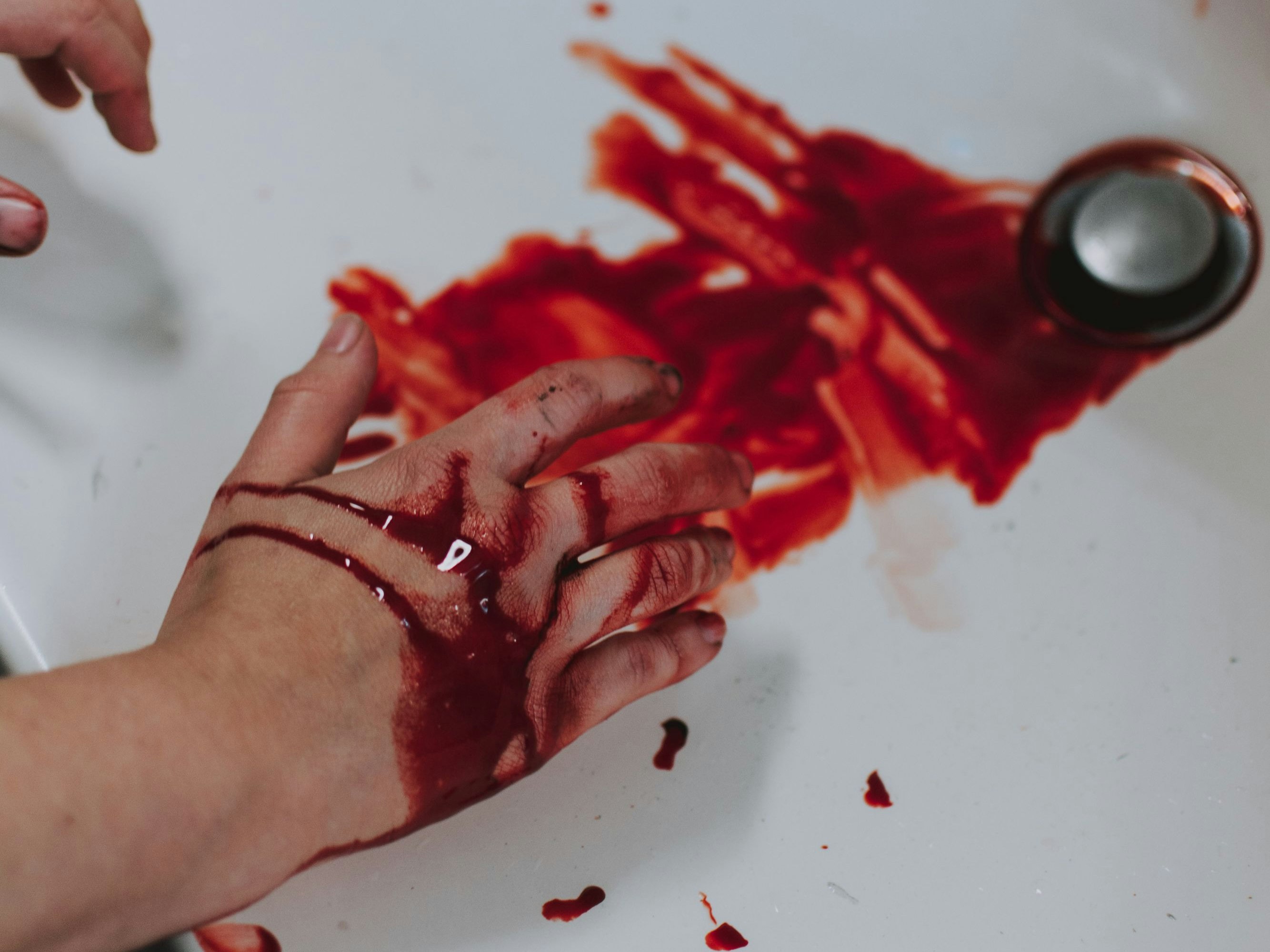 Zwei 17-jährige Schüler wurden bei dem Maturaball schwer verletzt.