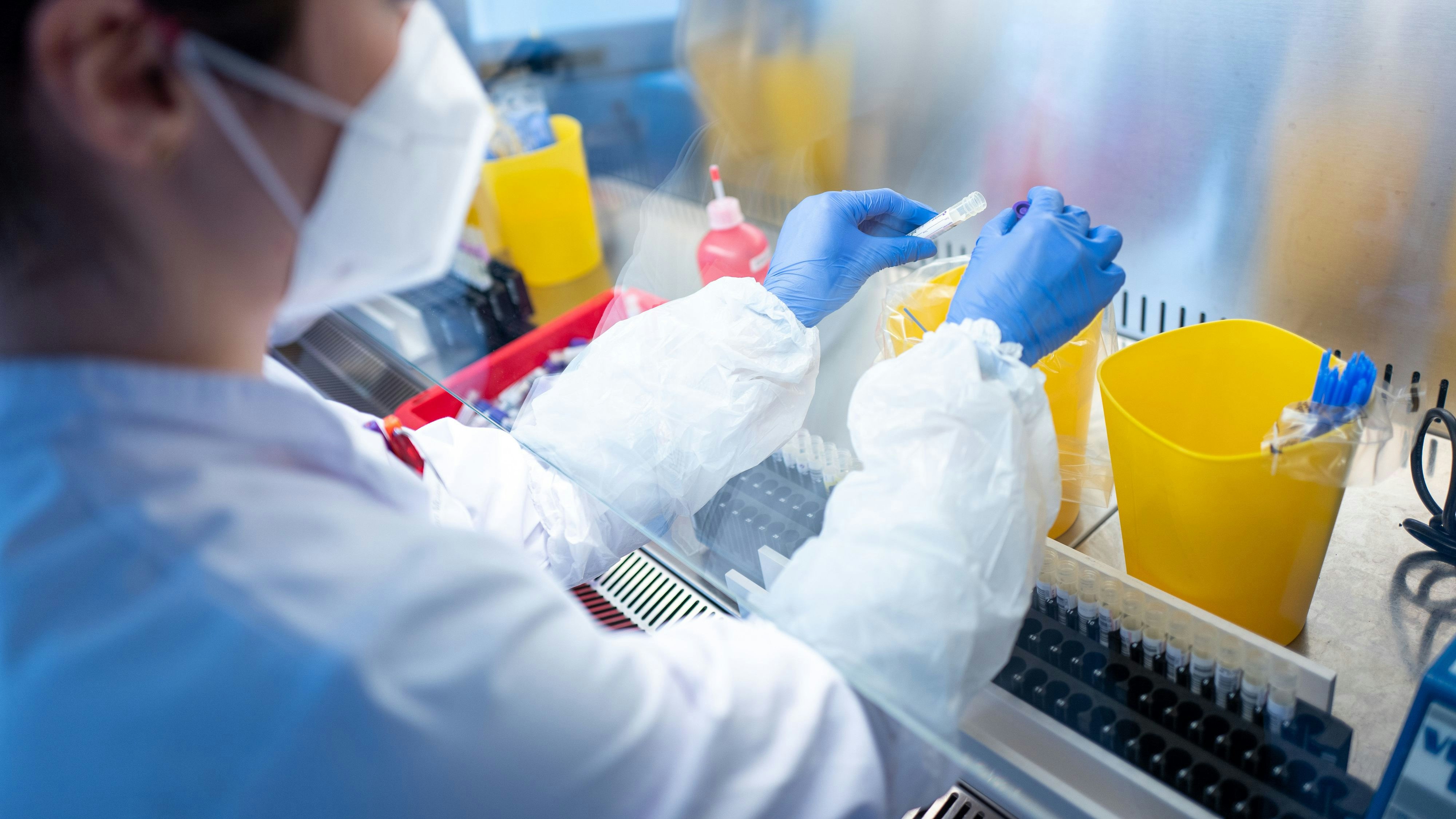 Alle Labore haben die Kapazitätsgrenzen erreicht.