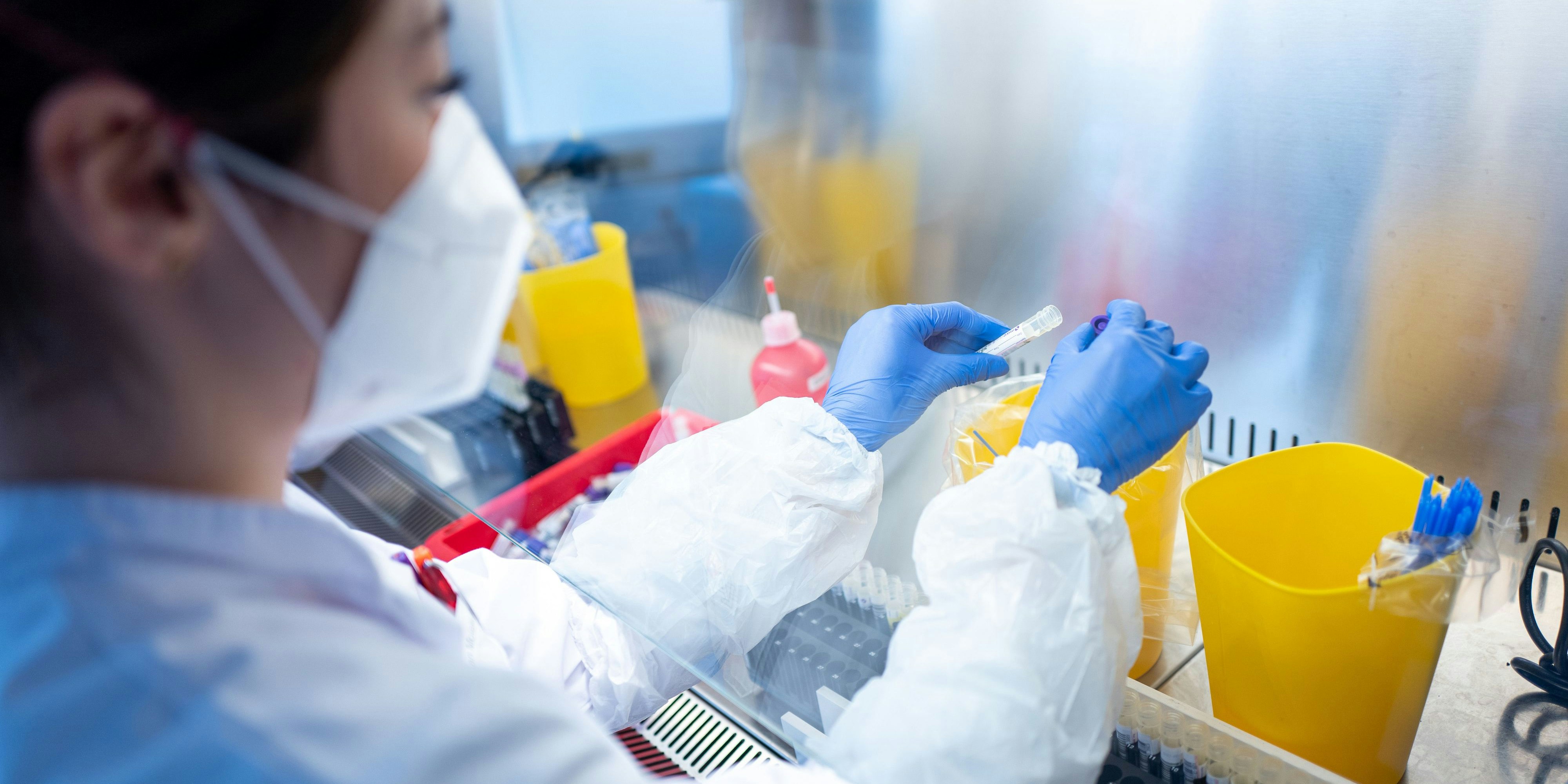 Die hohen Infektionszahlen stellen die Test-Labors vor fast unlösbare Herausforderungen.