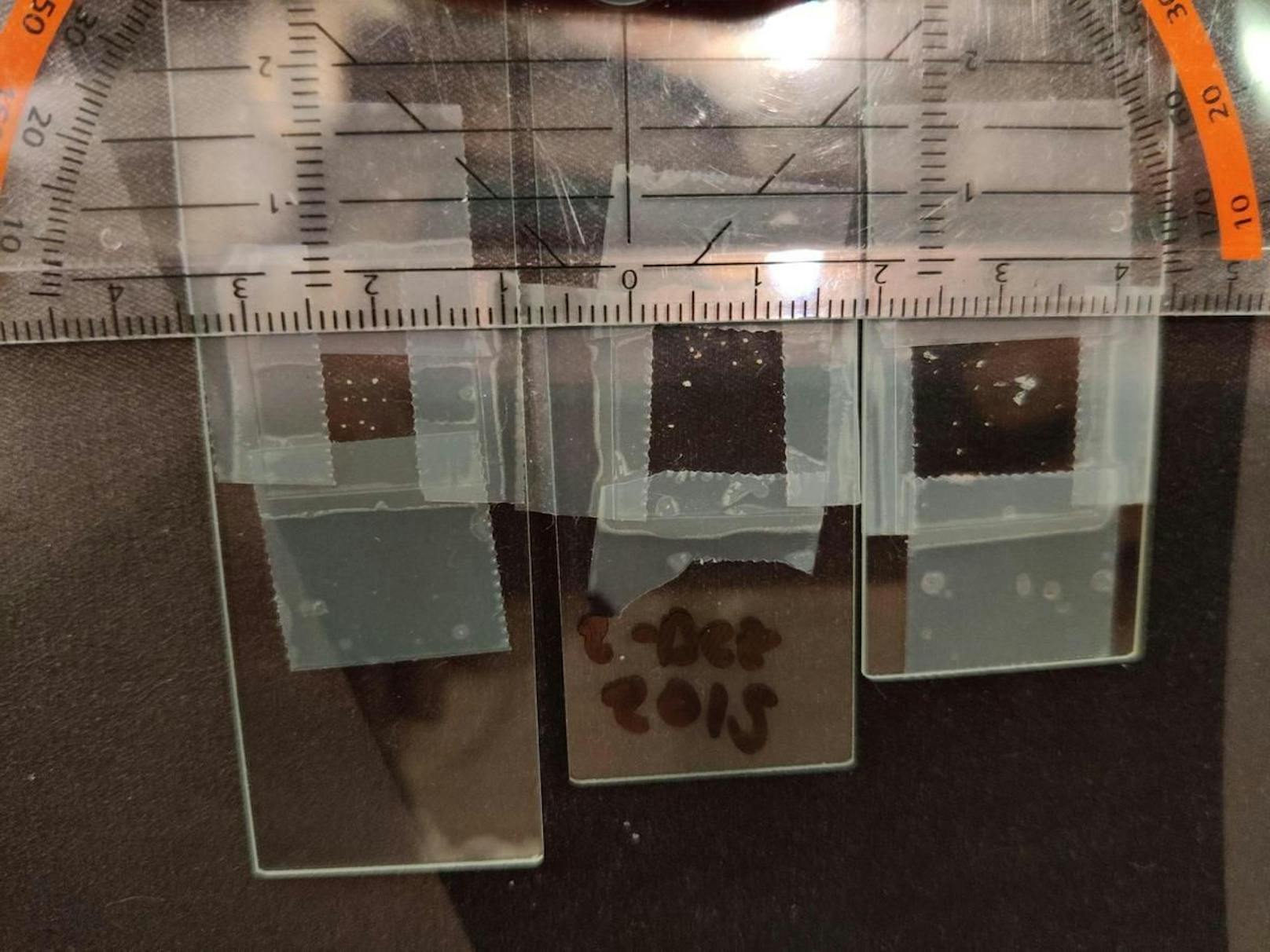 Eine Betroffene sammelte zum Beweis einige Milben in ihrem eigenen "Krätze-Friedhof".