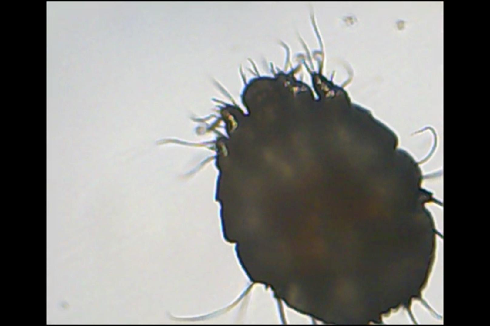 … und fotografierten die Parasiten unter dem Mikroskop.