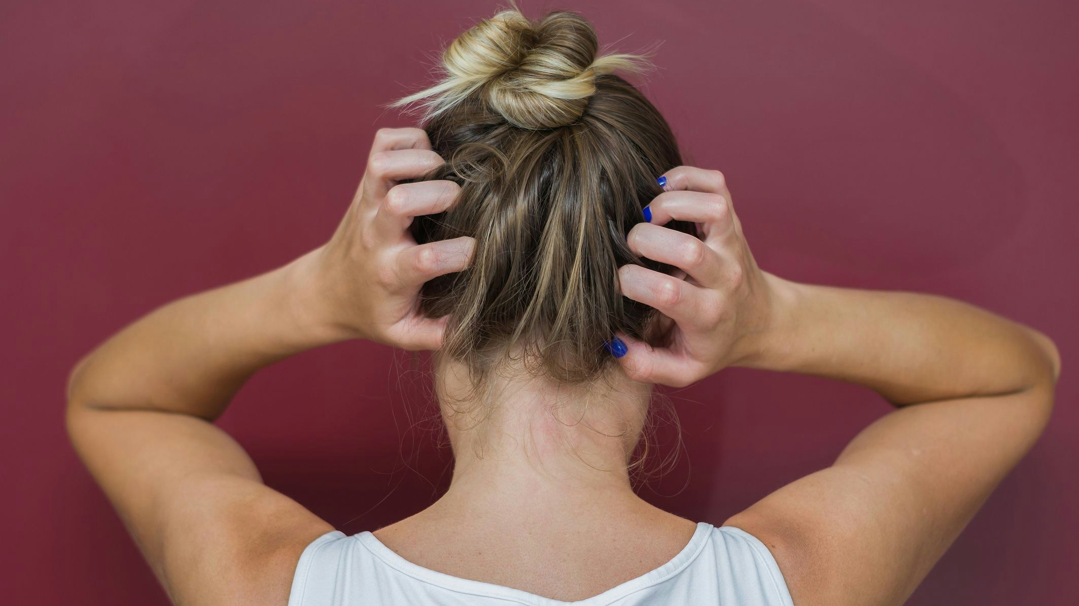 Eine juckende Kopfhaut kann viele Auslöser haben. 