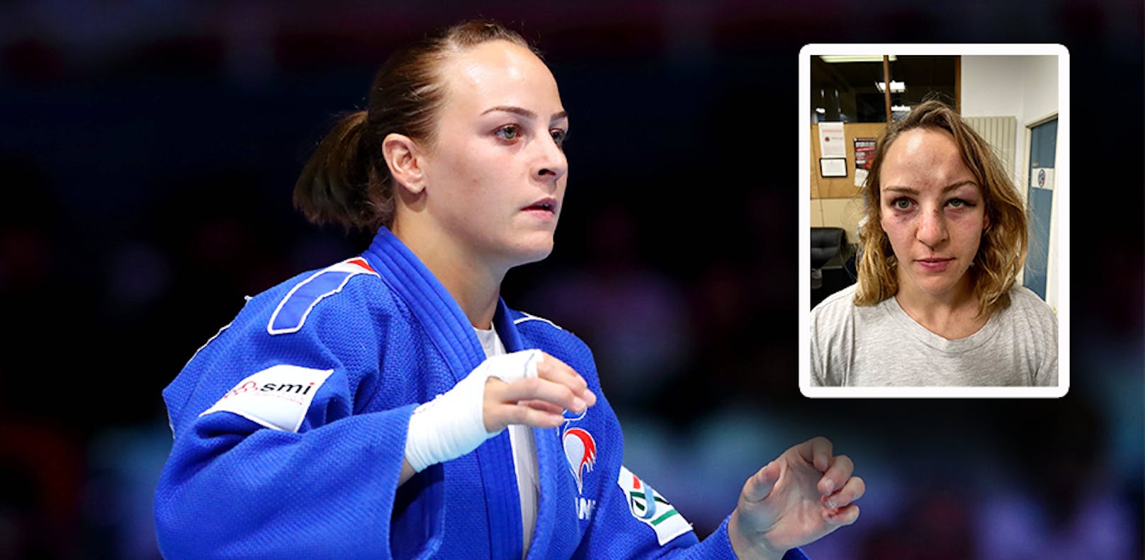 Judo-Olympiasiegerin von ihrem Partner attackiert