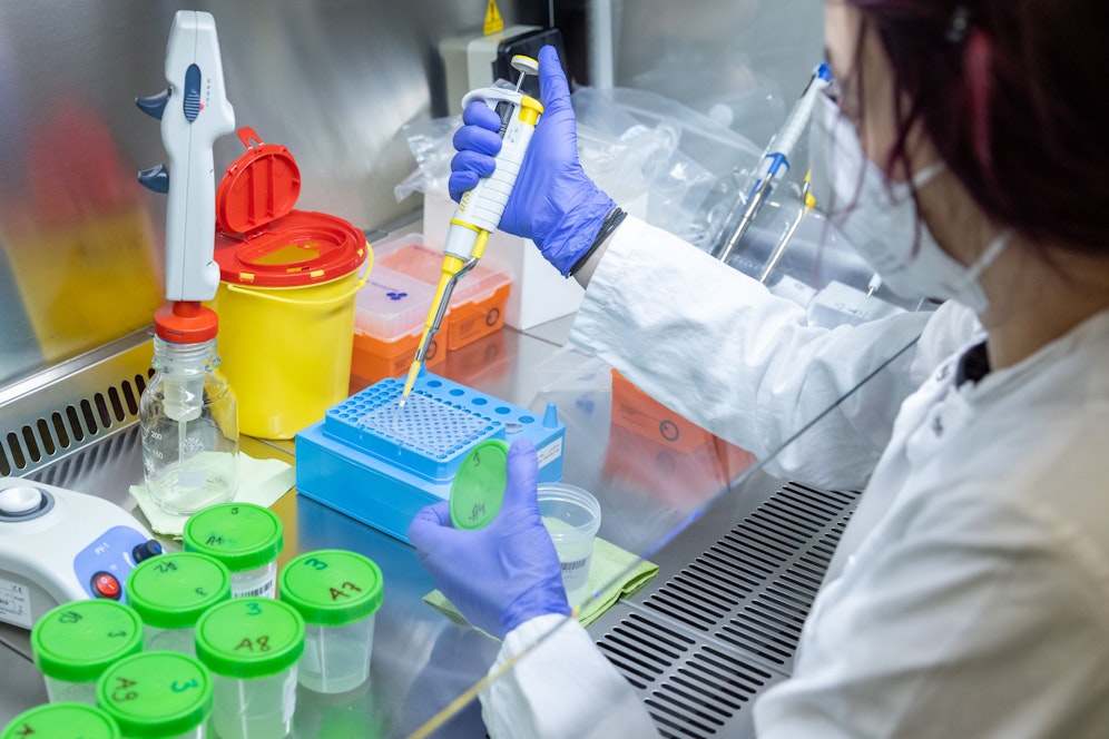 Nach einem PCR-Test gelten vier Südafrika-Reiserückkehrer als Verdachtsfall.
