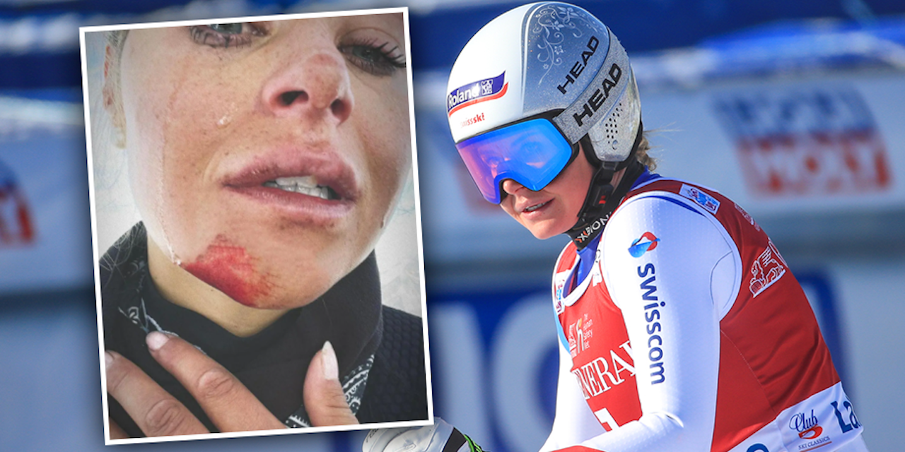 Blood and tears: ski star with emotional posting – winter sports