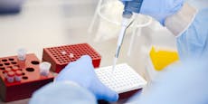 "Covitainer" machen PCR-Tests um 29 Euro möglich