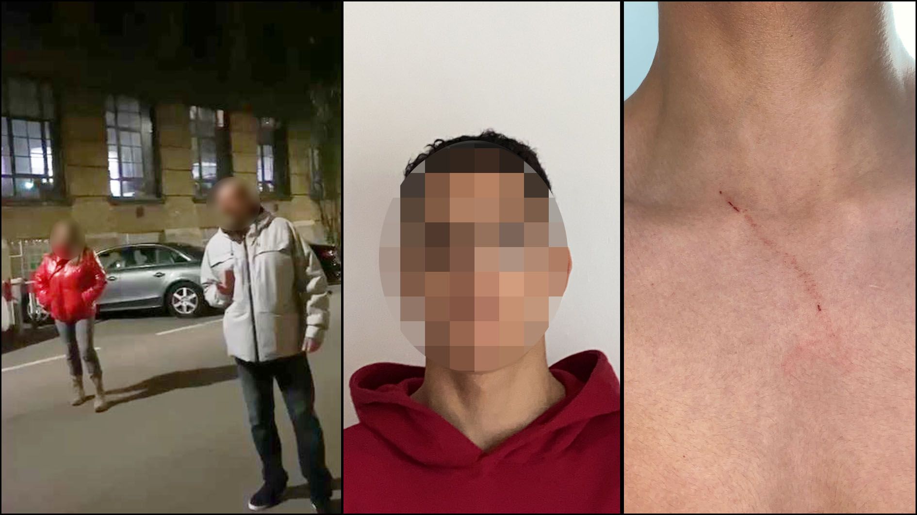 Das Pärchen (l.), der Tennie (m.) und sein zerkratztes Schlüsselbein (r.)