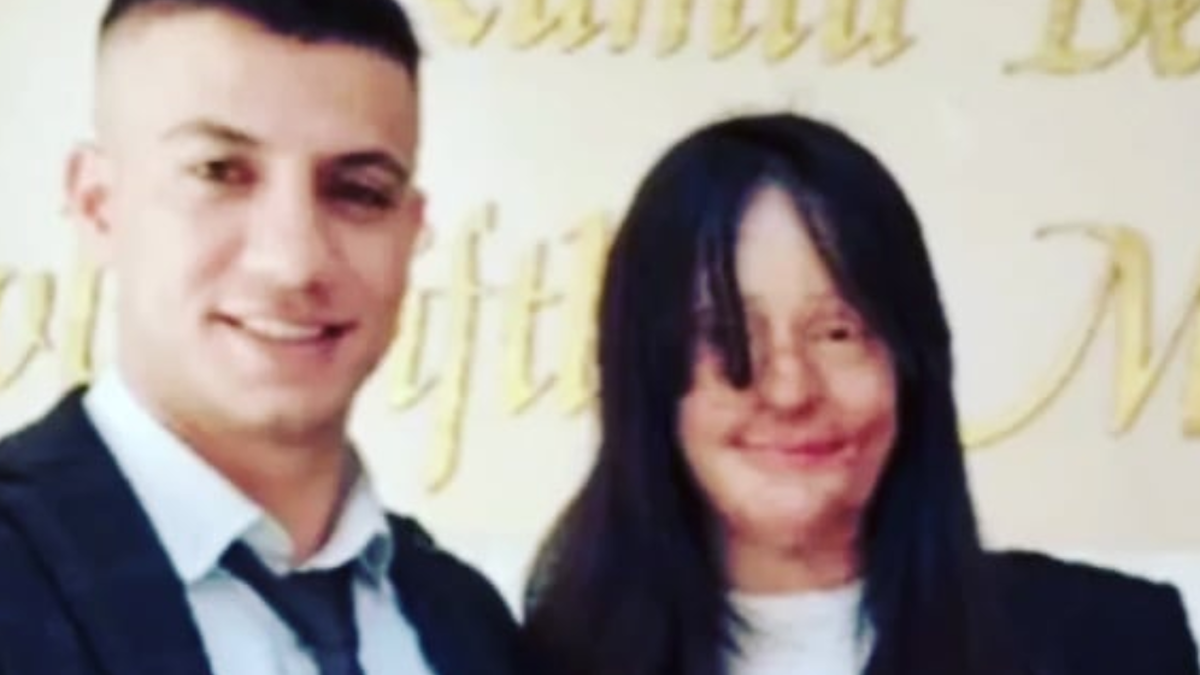 Eine 20-Jährige, die Opfer eines Säureangriffs wurde, heiratete ihren Angreifer.