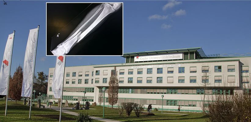Am Kepler Uni-Klinikum herrschte am Montag Hochbetrieb im Gipszimmer.