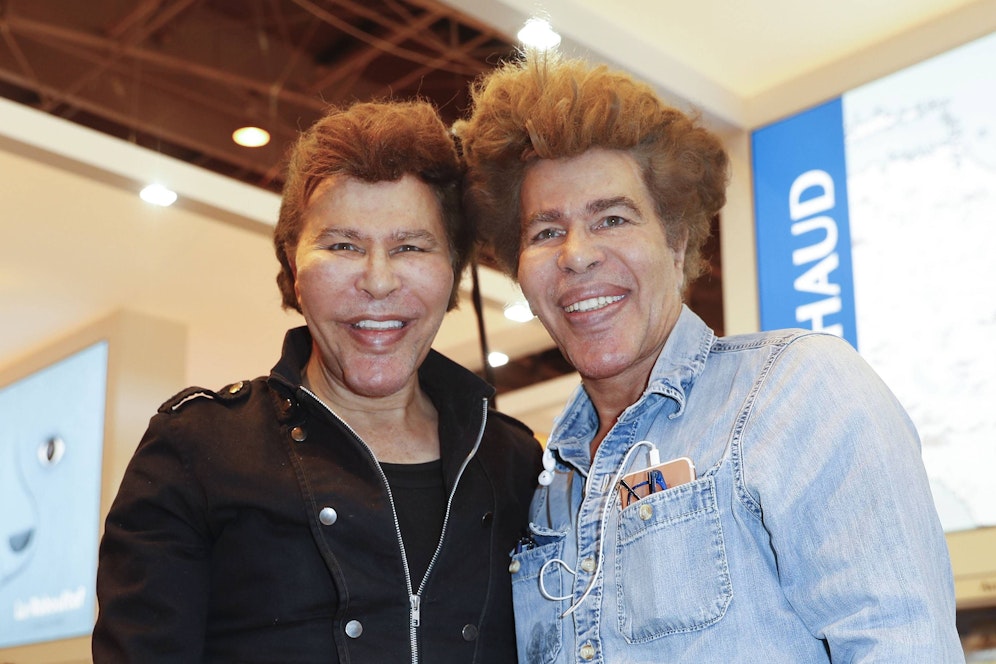 Die Zwillingsbrüder hatten zahlreiche Beauty-OPs hinter sich.